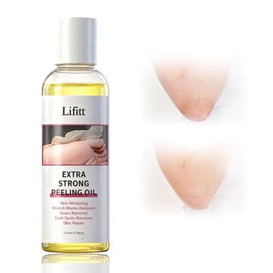 110ml Huile Éclaircissant la peau,Huile éclaircissant pour les Articulations,Oil Blanchissant pour Corps,Soin Quotidien,Teint Uniforme sur le Corps,Applicable Coudes et Genoux