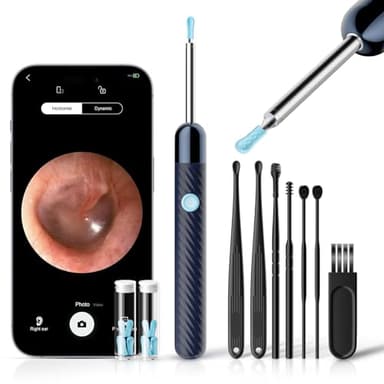 Otoscope Oreille 1080P HD Camera Oreille Nettoyage avec 6 LED Lumières - Équipé de 7 Cure-Oreilles Traditionnels - Nettoyeur Oreille Compatible iOS & Android (Bleu)